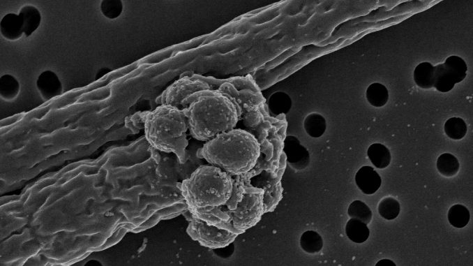 cyanobacterial filaments infected by parasite (c) Reingard Roßberg, IGB