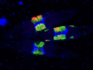 Eine Gruppe von Kieselalgen mit ihren Fluoreszenz-markierten Symbionten C: Max-Planck-Institut für Marine Mikrobiologie Bremen/Mertcan Esti