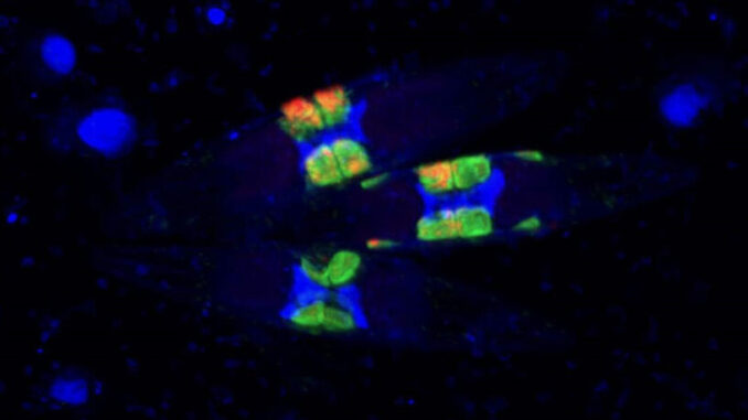 Eine Gruppe von Kieselalgen mit ihren Fluoreszenz-markierten Symbionten C: Max-Planck-Institut für Marine Mikrobiologie Bremen/Mertcan Esti